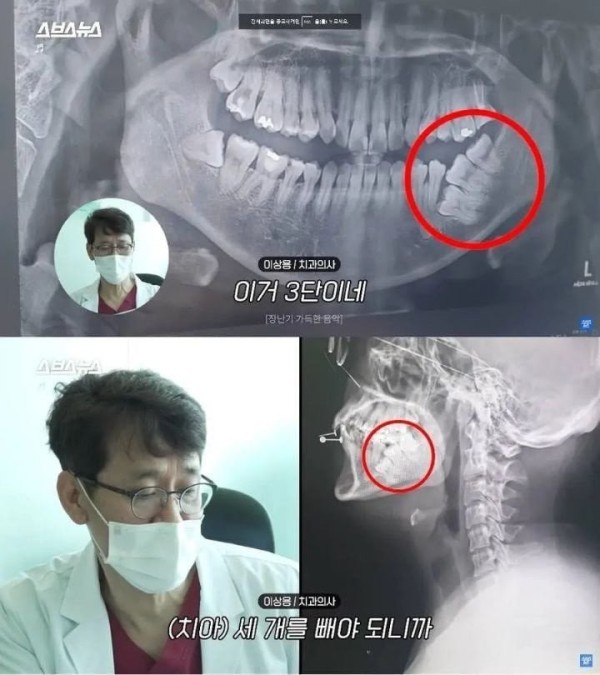 슬롯왕국,슬롯나라,슬롯,슬롯커뮤니티,잭팟,프라그마틱